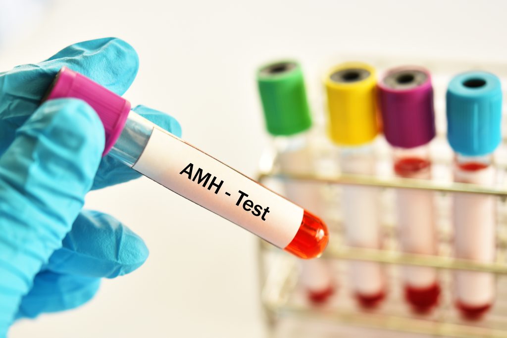AMH Testi Nedir? AMH Değeri Kaç Olmalı?