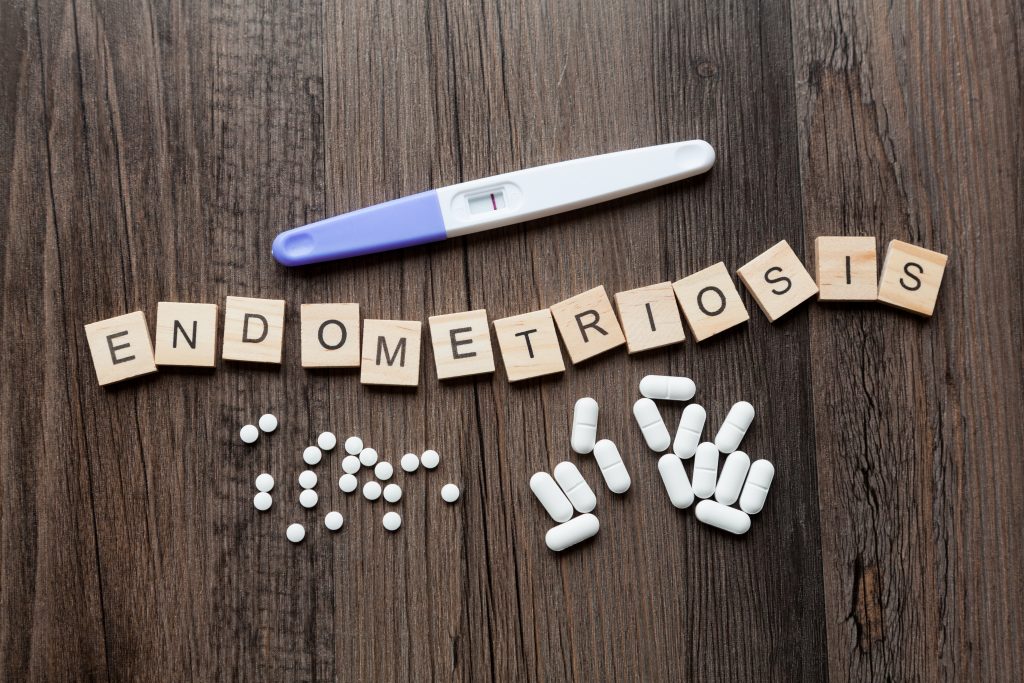 Endometriozis (Çikolata Kisti) Nedir? Ağrı Yapar mı?